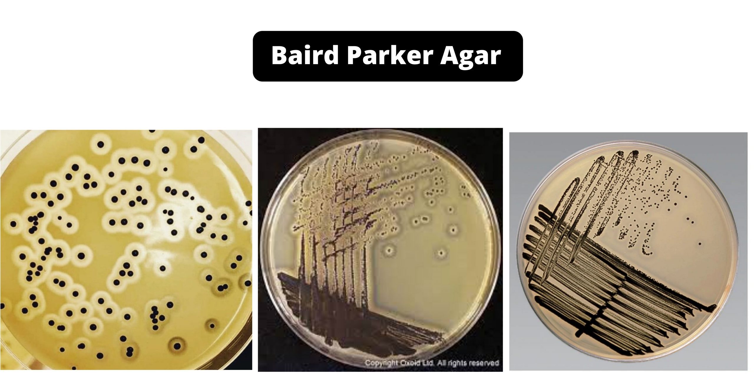 Baird Parker Agar - Composition, Principle, Preparation, Results, Uses