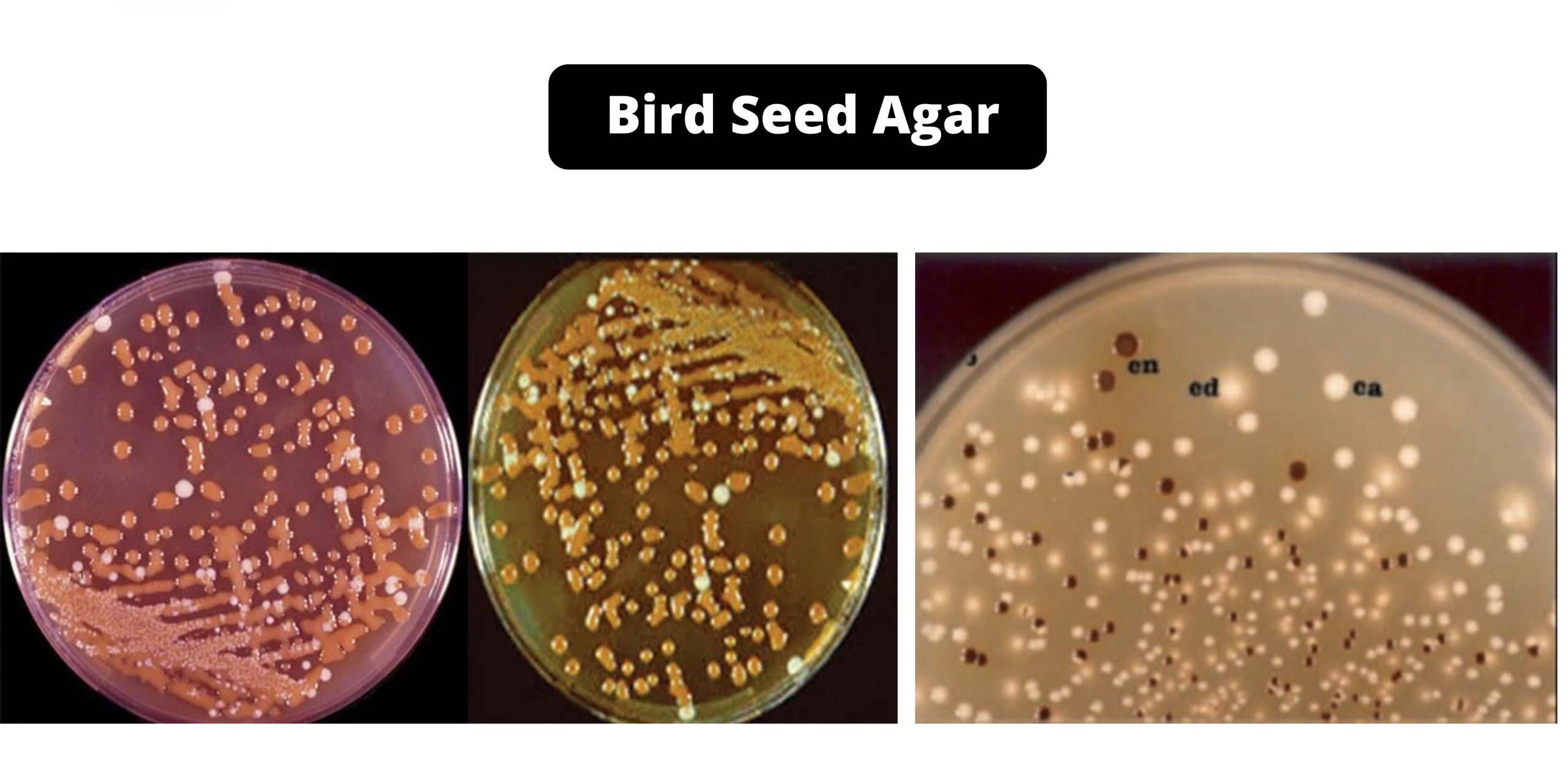 Bird Seed Agar (Staibs Medium) Composition, Principle, Preparation