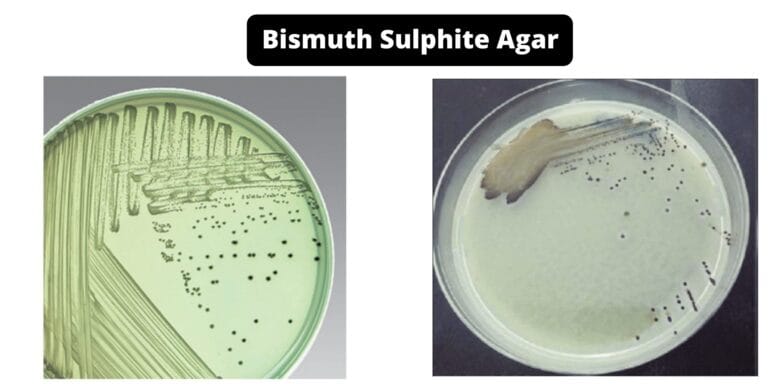 Bismuth Sulphite Agar (BSA) - Composition, Principle, Preparation, Results, Uses