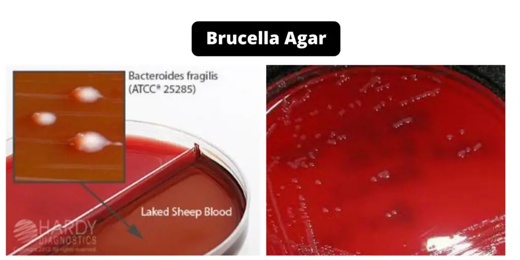 Brucella Agar - Composition, Principle, Preparation, Results, Uses ...