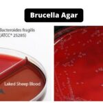 Brucella Agar - Composition, Principle, Preparation, Results, Uses