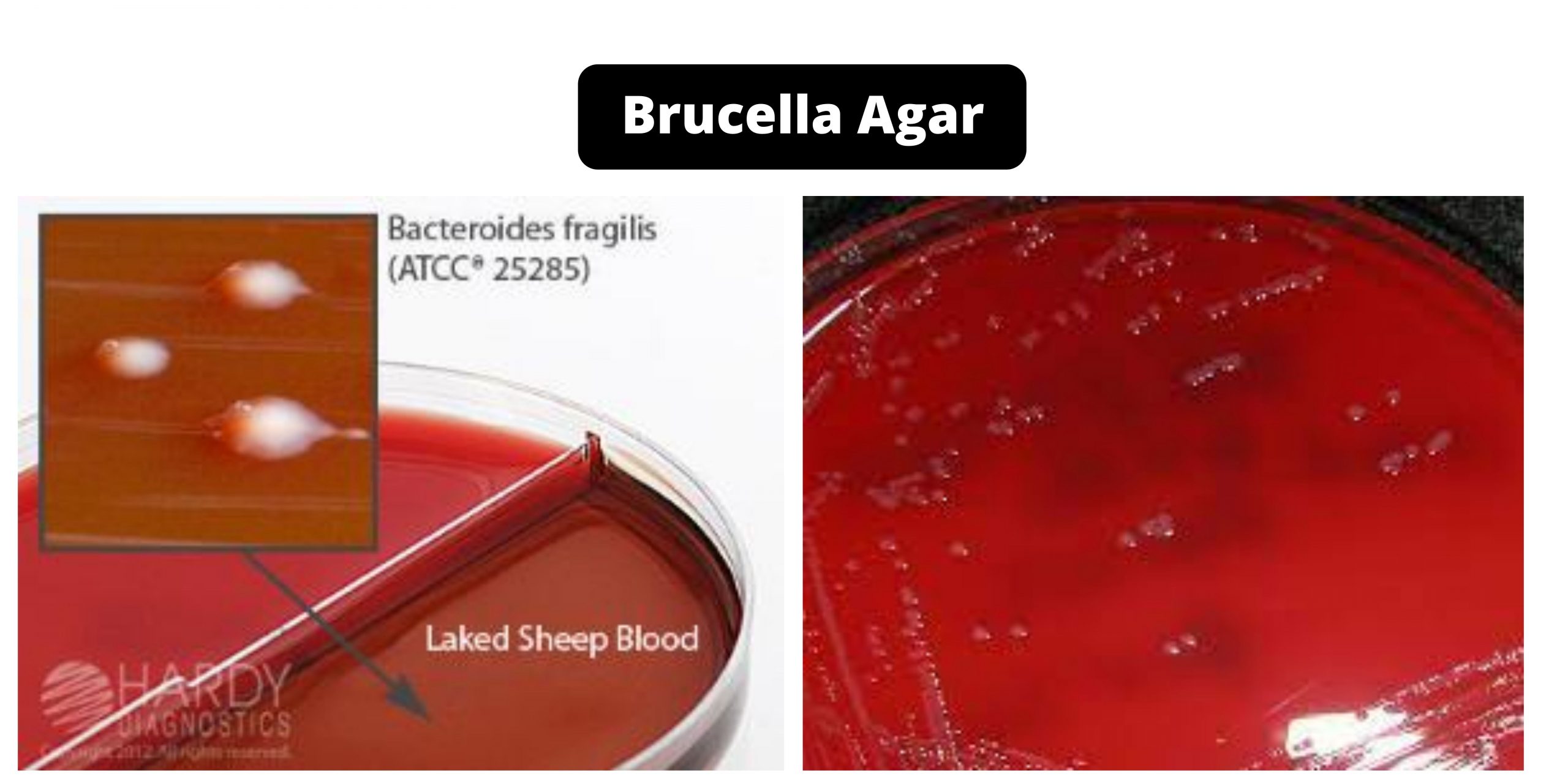 Brucella Agar - Composition, Principle, Preparation, Results, Uses