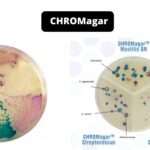 CHROMagar - Composition, Principle, Preparation, Results, Uses