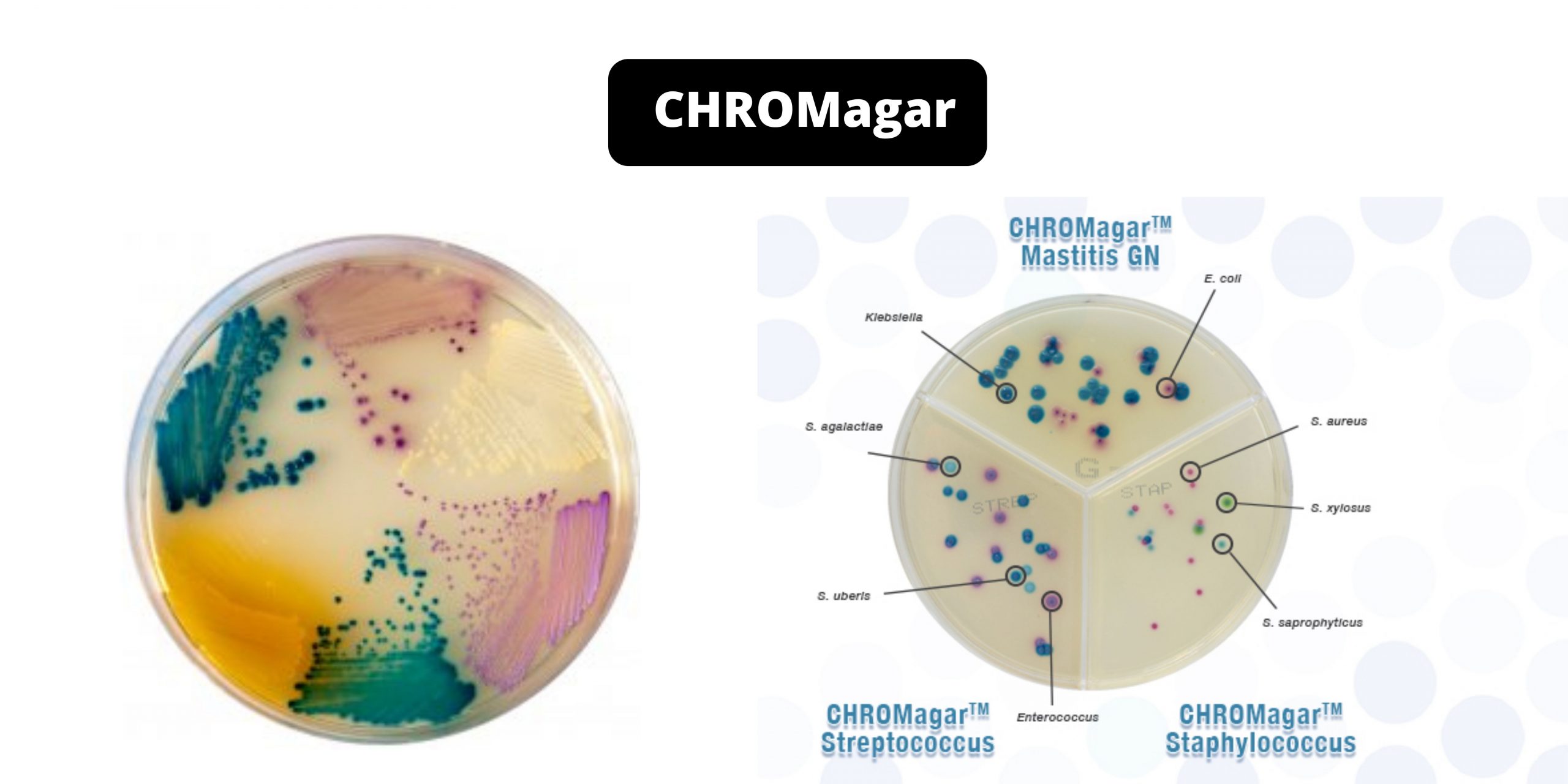 CHROMagar - Composition, Principle, Preparation, Results, Uses