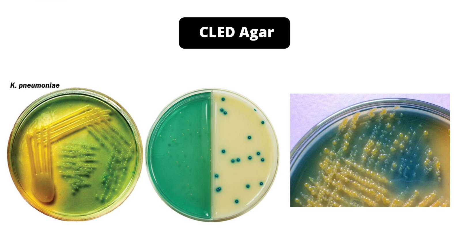 CLED Agar - Composition, Principle, Preparation, Results, Uses