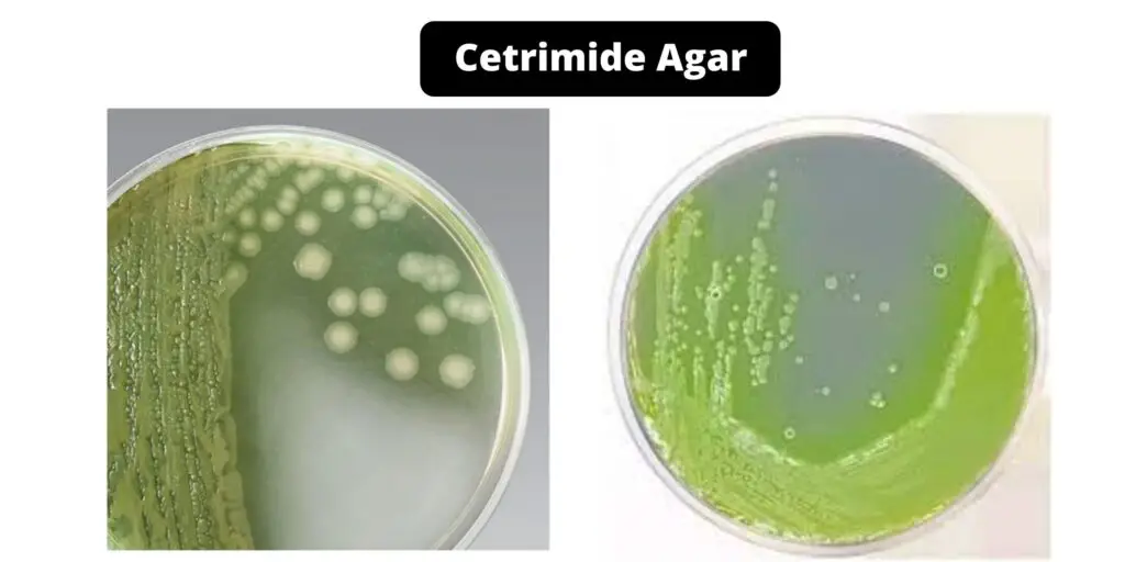 Cetrimide Agar - Composition, Principle, Preparation, Results, Uses ...