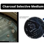 Charcoal Selective Medium - Composition, Principle, Preparation, Results, Uses