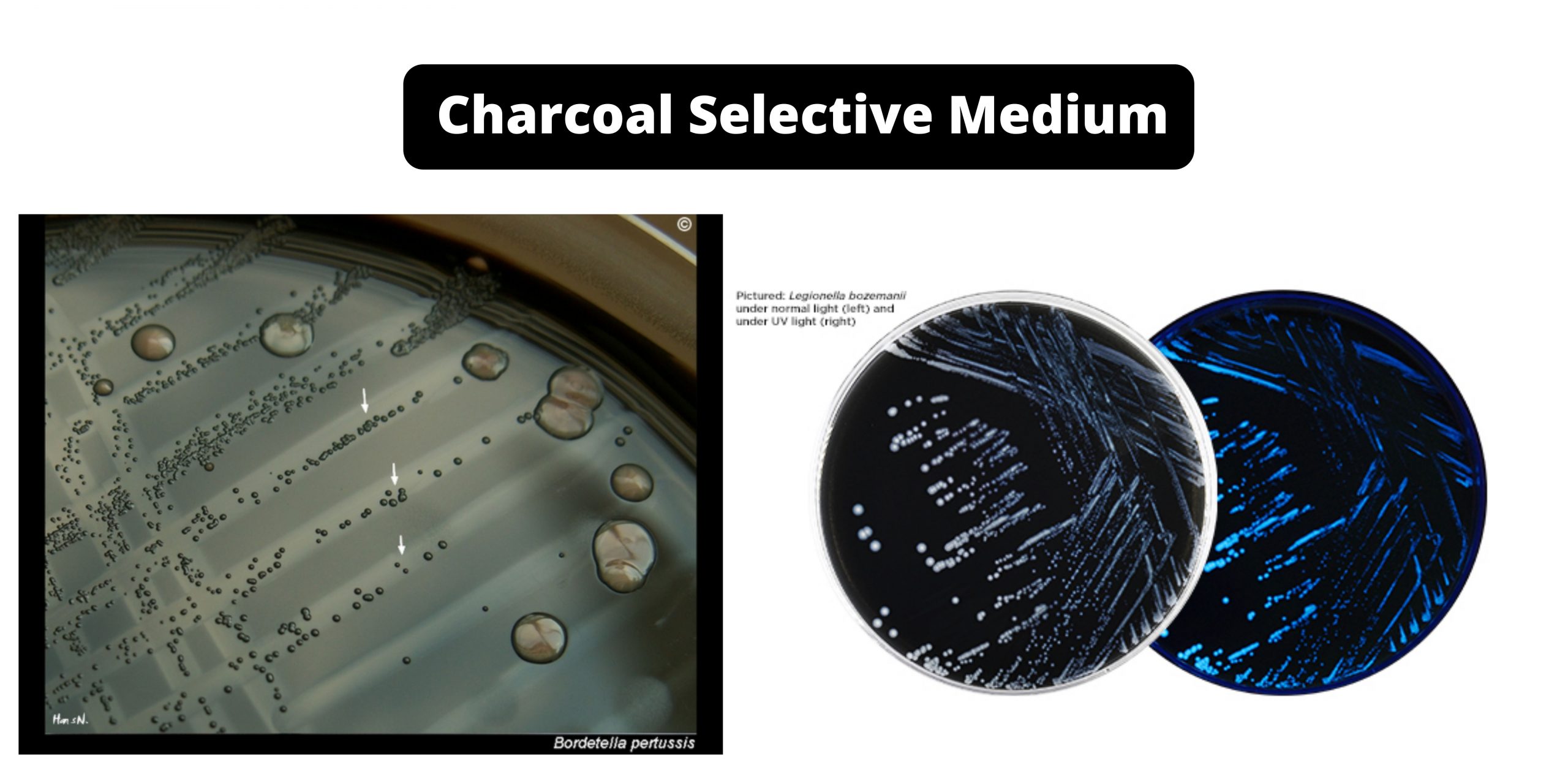 Charcoal Selective Medium - Composition, Principle, Preparation, Results, Uses