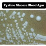 Cystine Glucose Blood Agar Composition, Principle, Preparation, Results, Uses