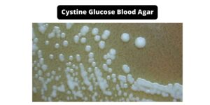 Cystine Glucose Blood Agar – Composition, Principle, Preparation, Results, Uses