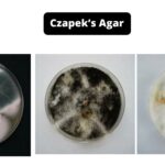 Czapek’s Agar (CZA) - Composition, Principle, Preparation, Results, Uses