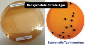 Deoxycholate Citrate Agar (DCA) – Composition, Principle, Preparation, Results, Uses