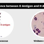 Difference between O antigen and H antigen - O vs H antigen