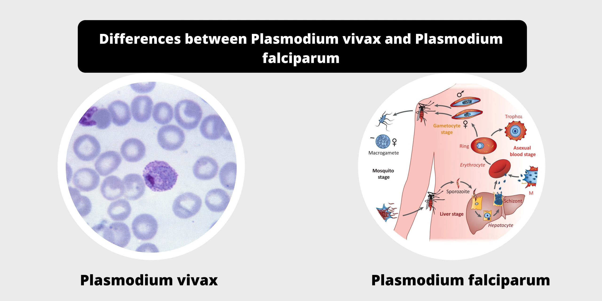 Differences between Plasmodium vivax and Plasmodium falciparum