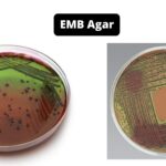 EMB Agar - Composition, Principle, Preparation, Results, Uses