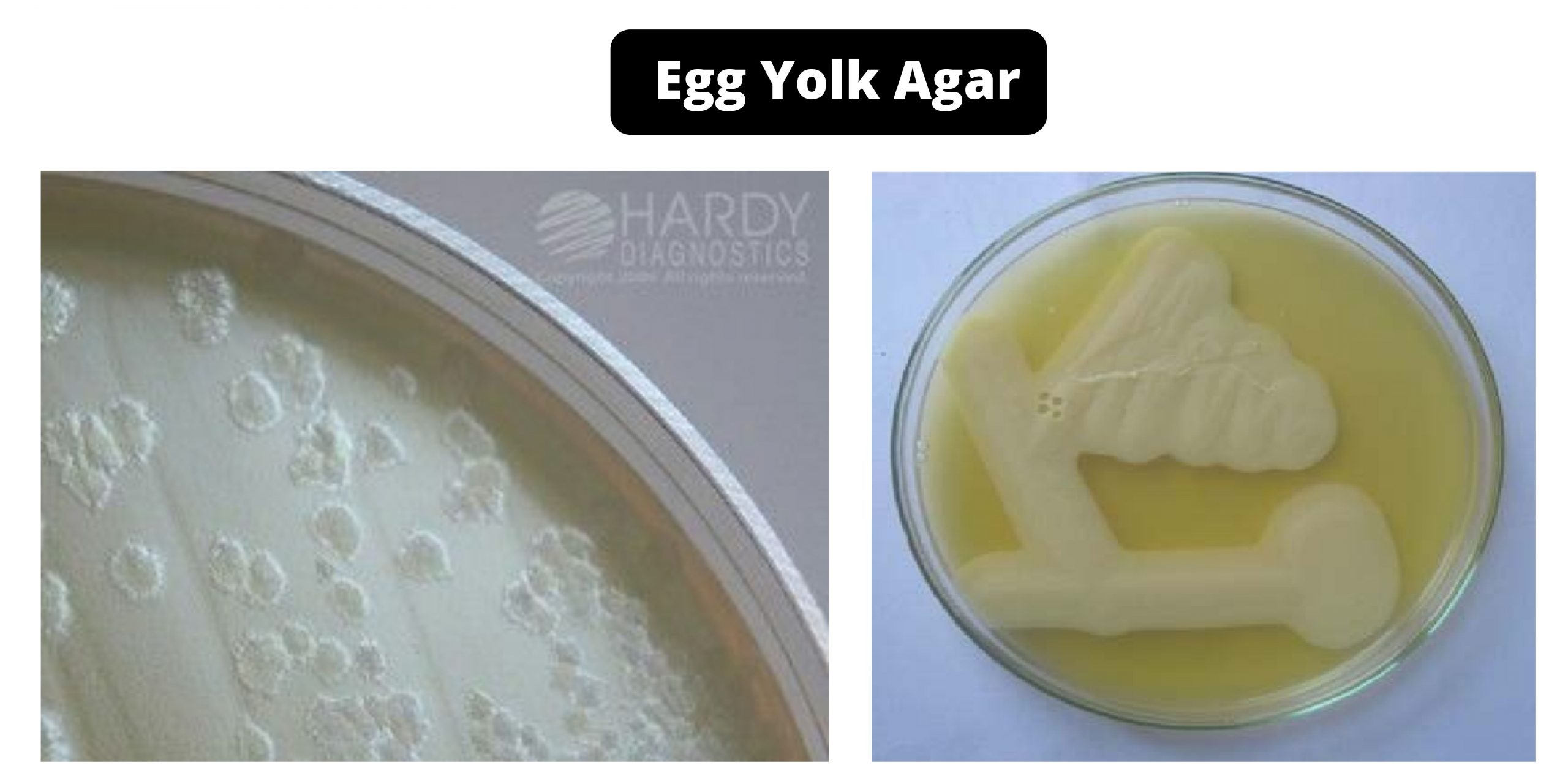 Egg Yolk Agar Composition, Principle, Preparation, Results, Uses