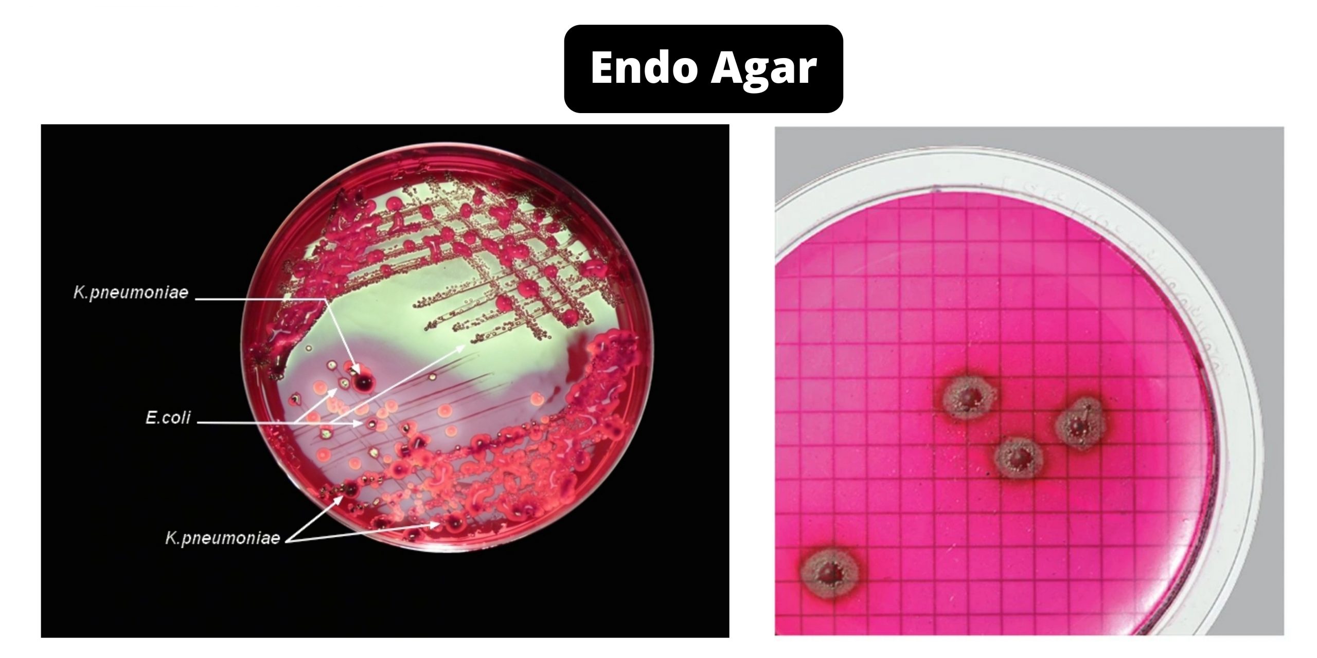 Endo Agar - Composition, Principle, Preparation, Results, Uses