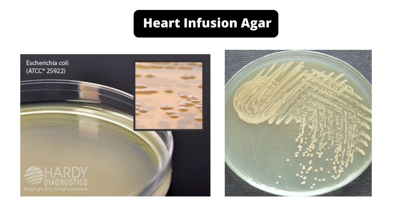 Heart Infusion Agar - Composition, Principle, Preparation, Results, Uses