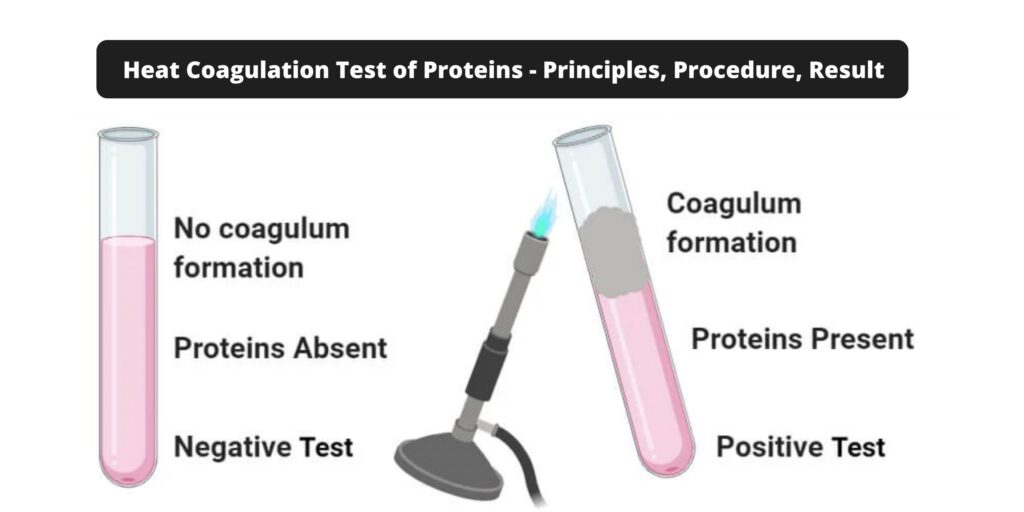 Heat Coagulation Test of Proteins - Principles, Procedure, Result ...