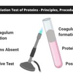 Heat Coagulation Test of Proteins - Principles, Procedure, Result