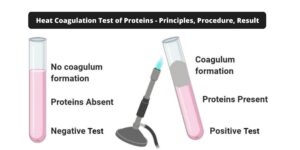 Heat Coagulation Test of Proteins – Principles, Procedure, Result