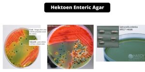 Hektoen Enteric Agar – Composition, Principle, Preparation, Results, Uses