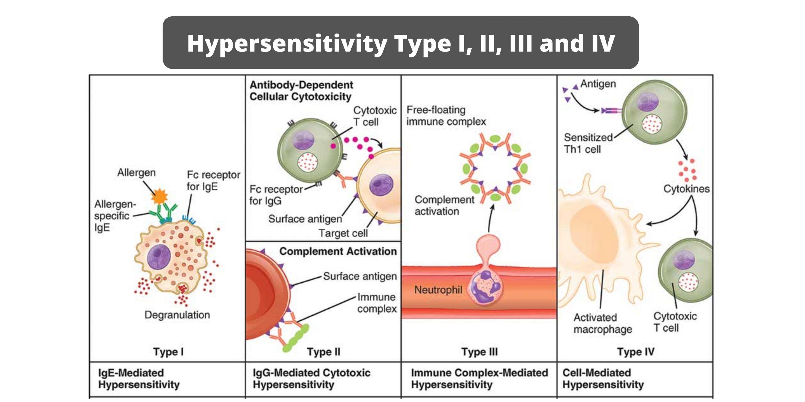 Hypersensitivity Type I, II, III and IV- Summary in table form