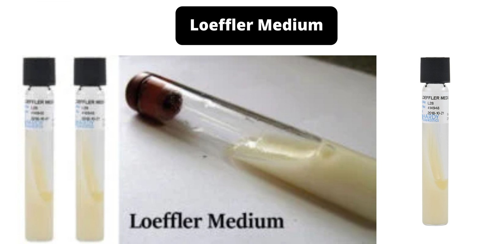 Loeffler Medium - Composition, Principle, Preparation, Results, Uses