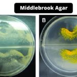 Middlebrook Agar - Composition, Principle, Preparation, Results, Uses