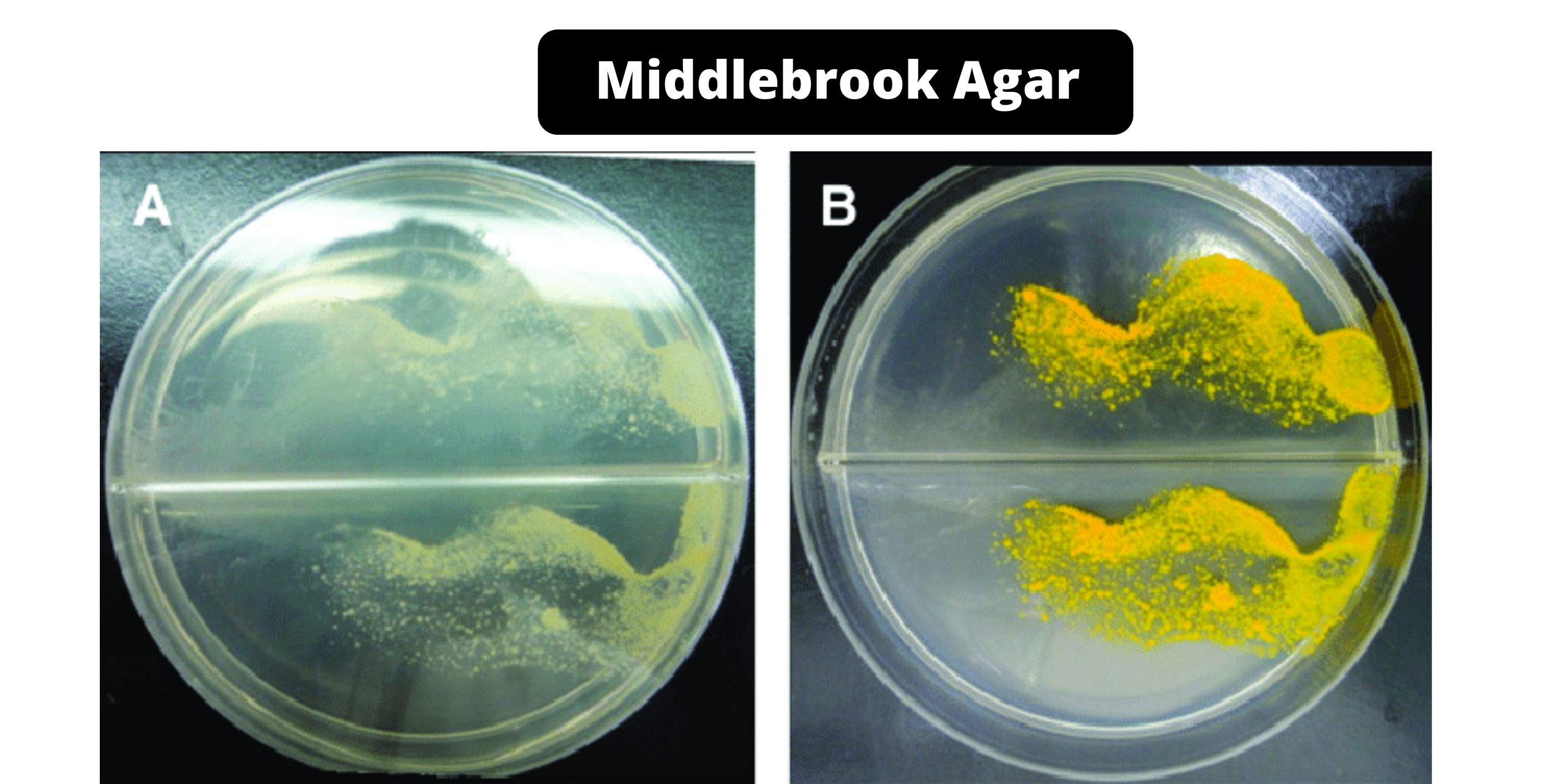 Middlebrook Agar - Composition, Principle, Preparation, Results, Uses