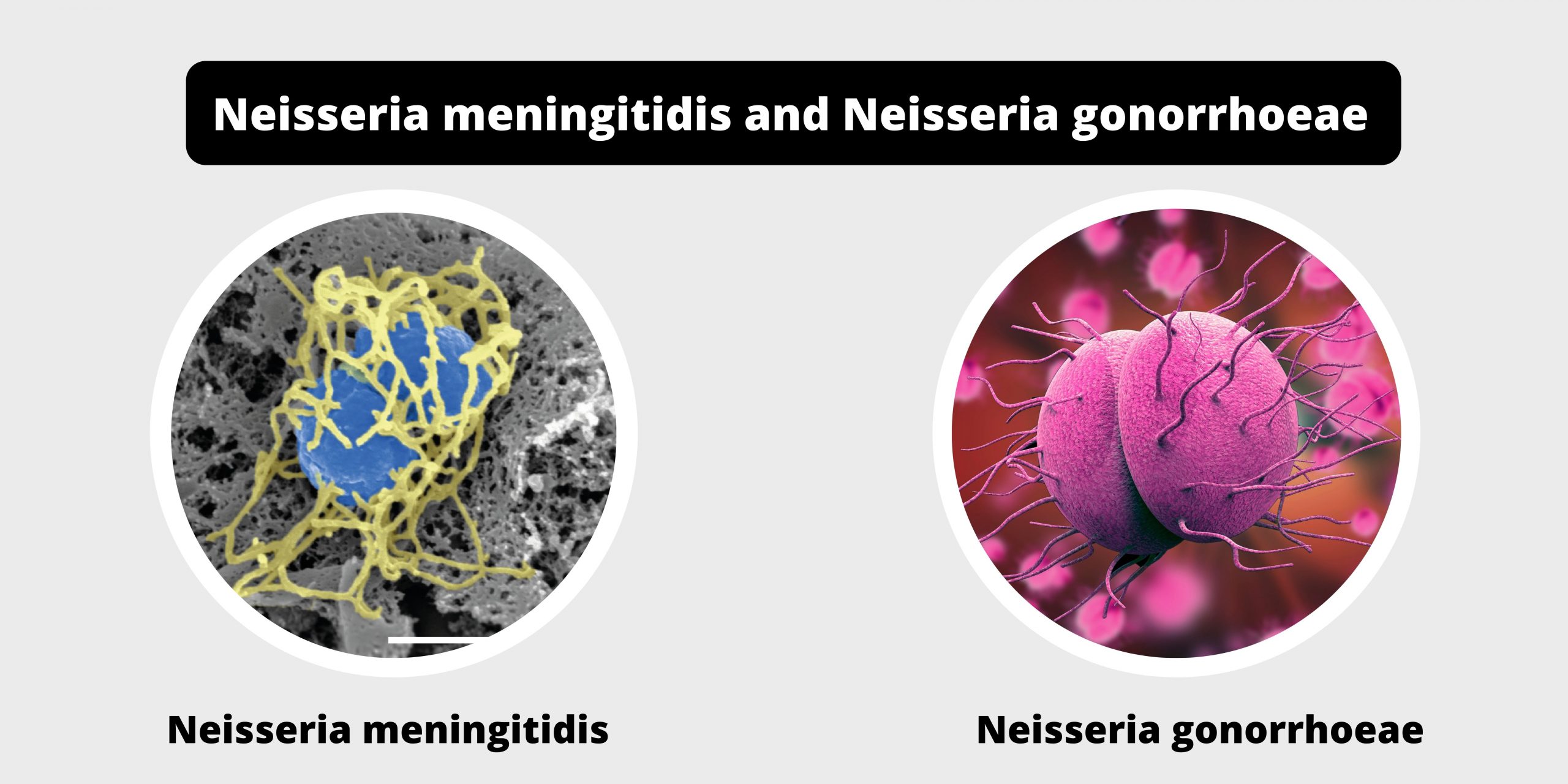 Differences between Neisseria meningitidis and Neisseria gonorrhoeae