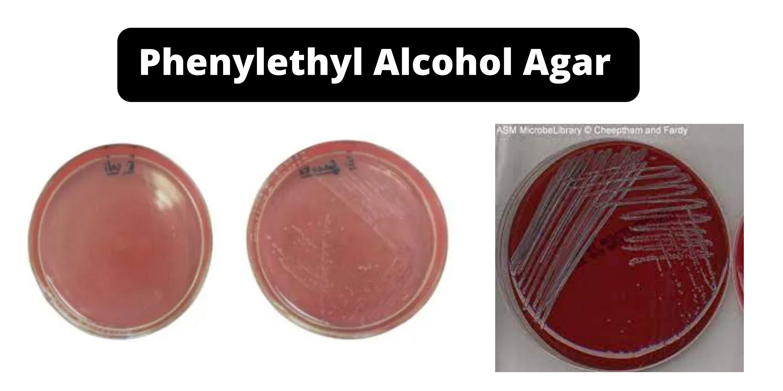 Phenylethyl Alcohol Agar - Composition, Preparation, Uses, Limitation