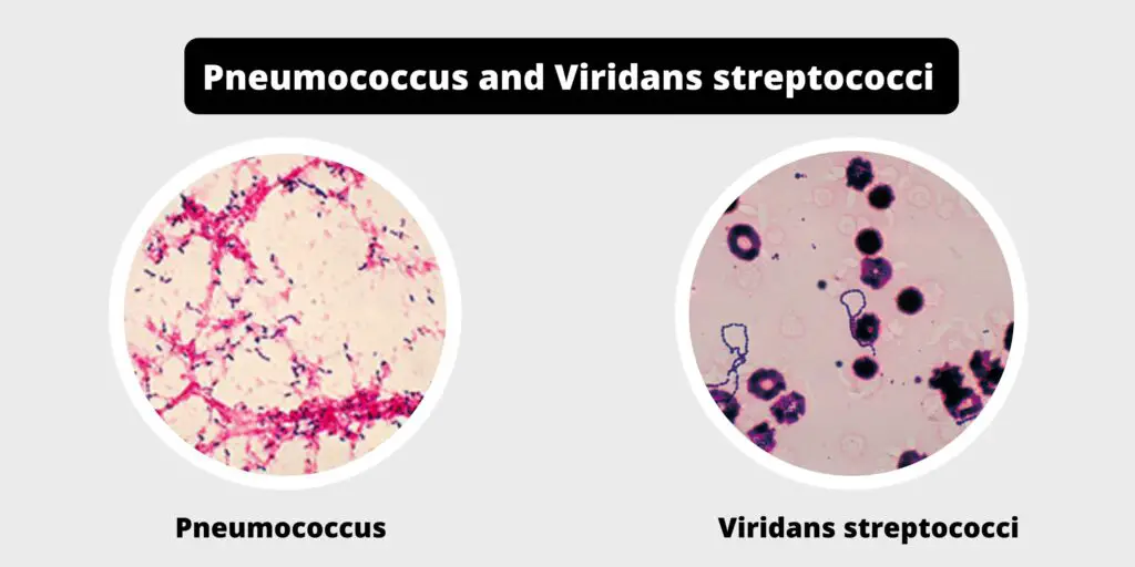 differences-between-pneumococcus-and-viridans-streptococci-biology