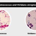 Differences between Pneumococcus and Viridans streptococci