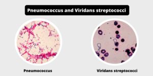 Differences between Pneumococcus and Viridans streptococci