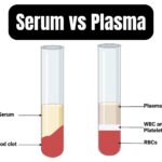 Differences between Serum and Plasma - Serum vs Plasma