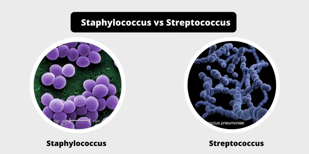 Differences between Staphylococcus and Streptococcus - Biology Notes Online