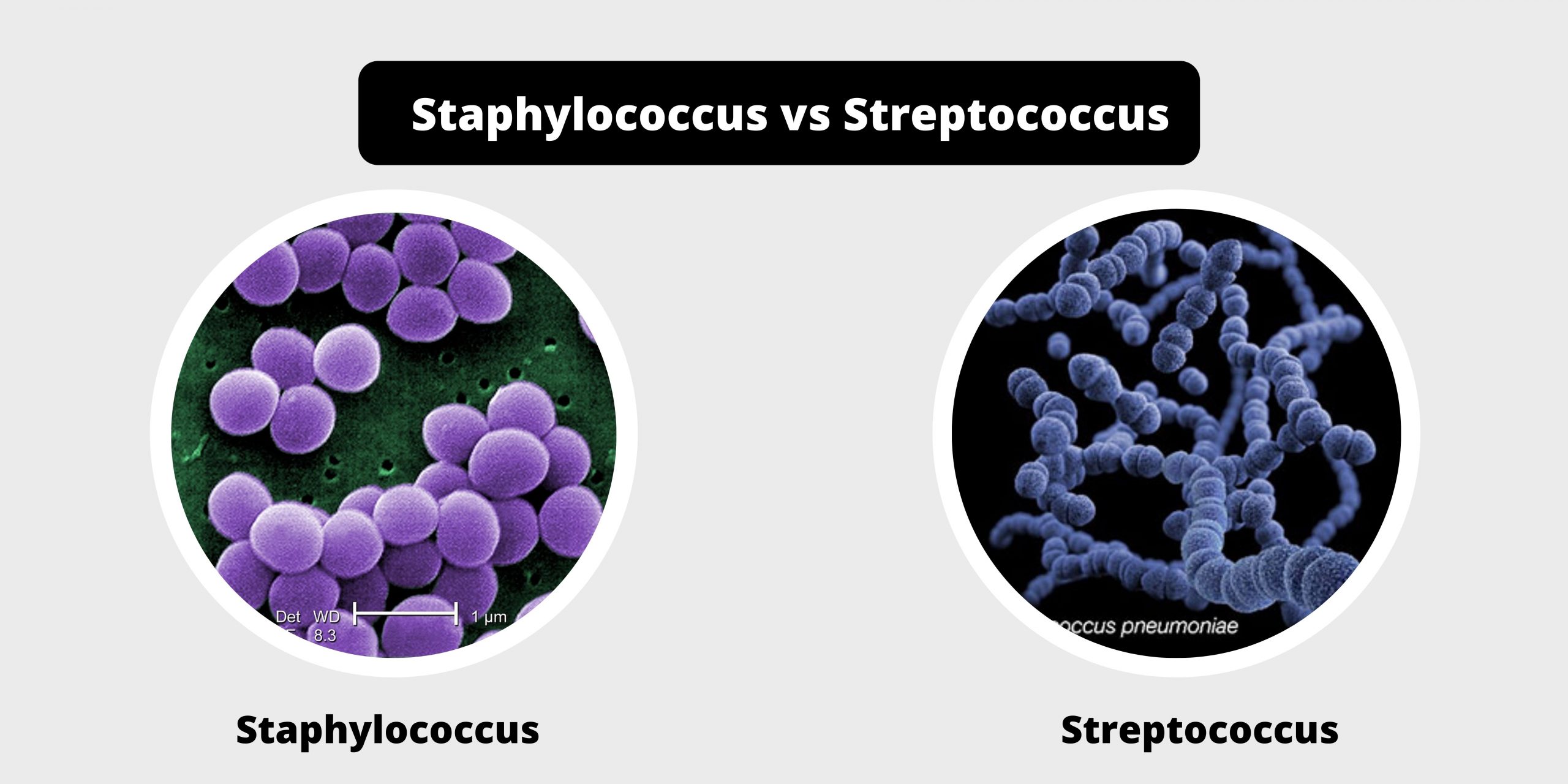 Differences between Staphylococcus and Streptococcus