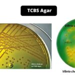 TCBS Agar - Composition, Principle, Preparation, Results, Uses