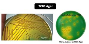 TCBS Agar – Composition, Principle, Preparation, Results, Uses