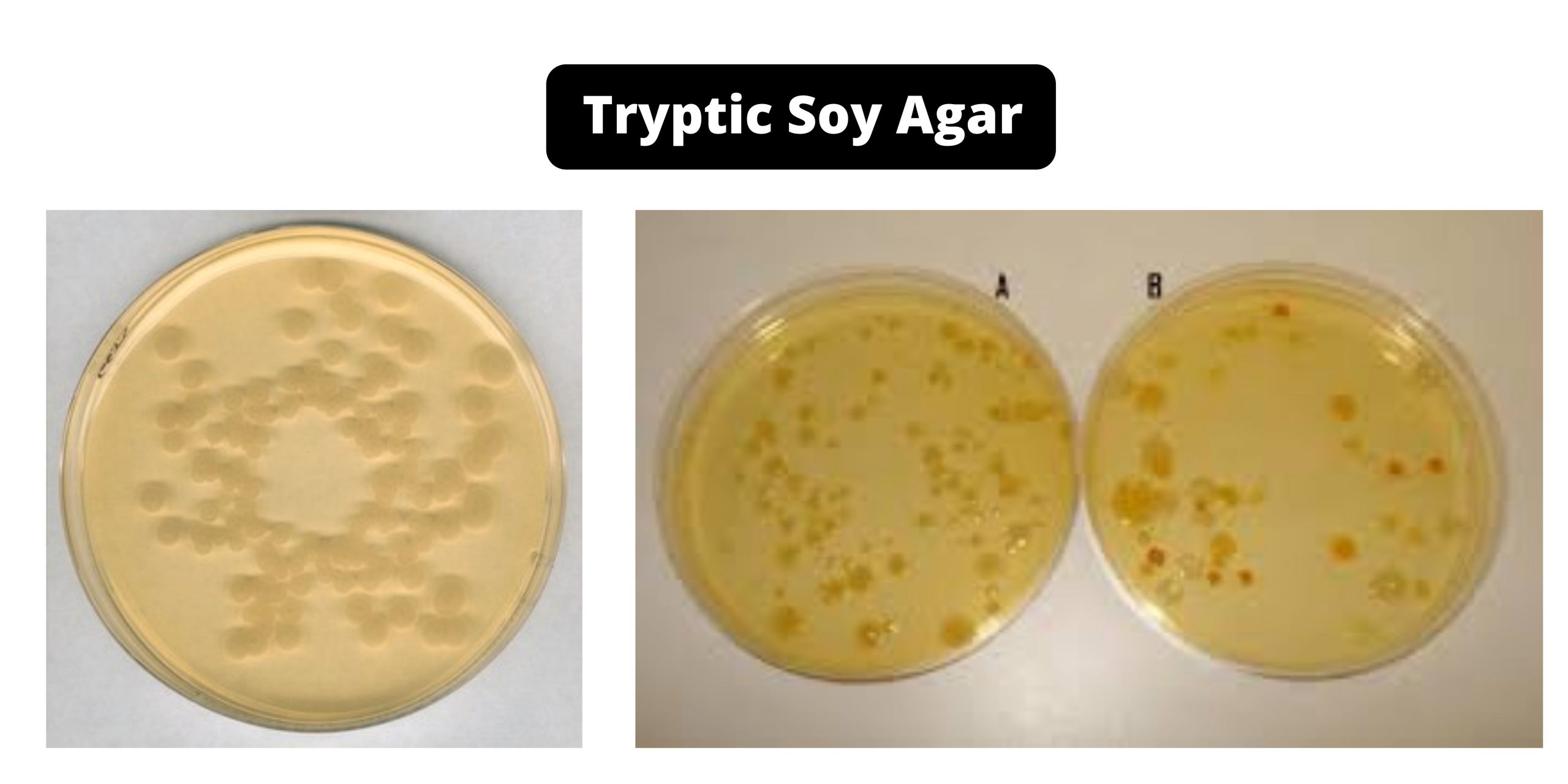 Tryptic Soy Agar (TSA) - Composition, Principle, Preparation, Results, Uses