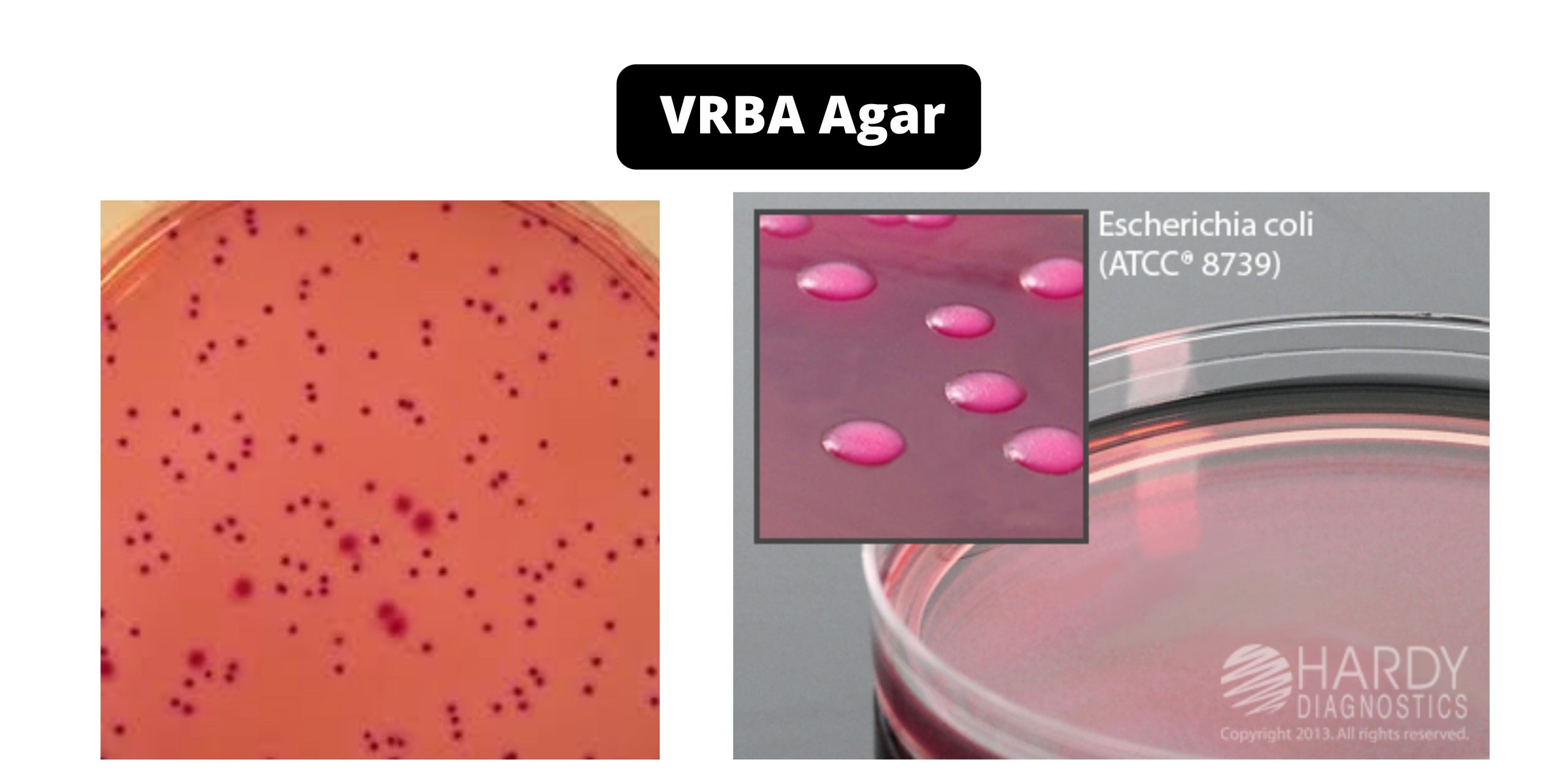 VRBA(Violet Red Bile Agar) - Composition, Principle, Preparation, Results, Uses