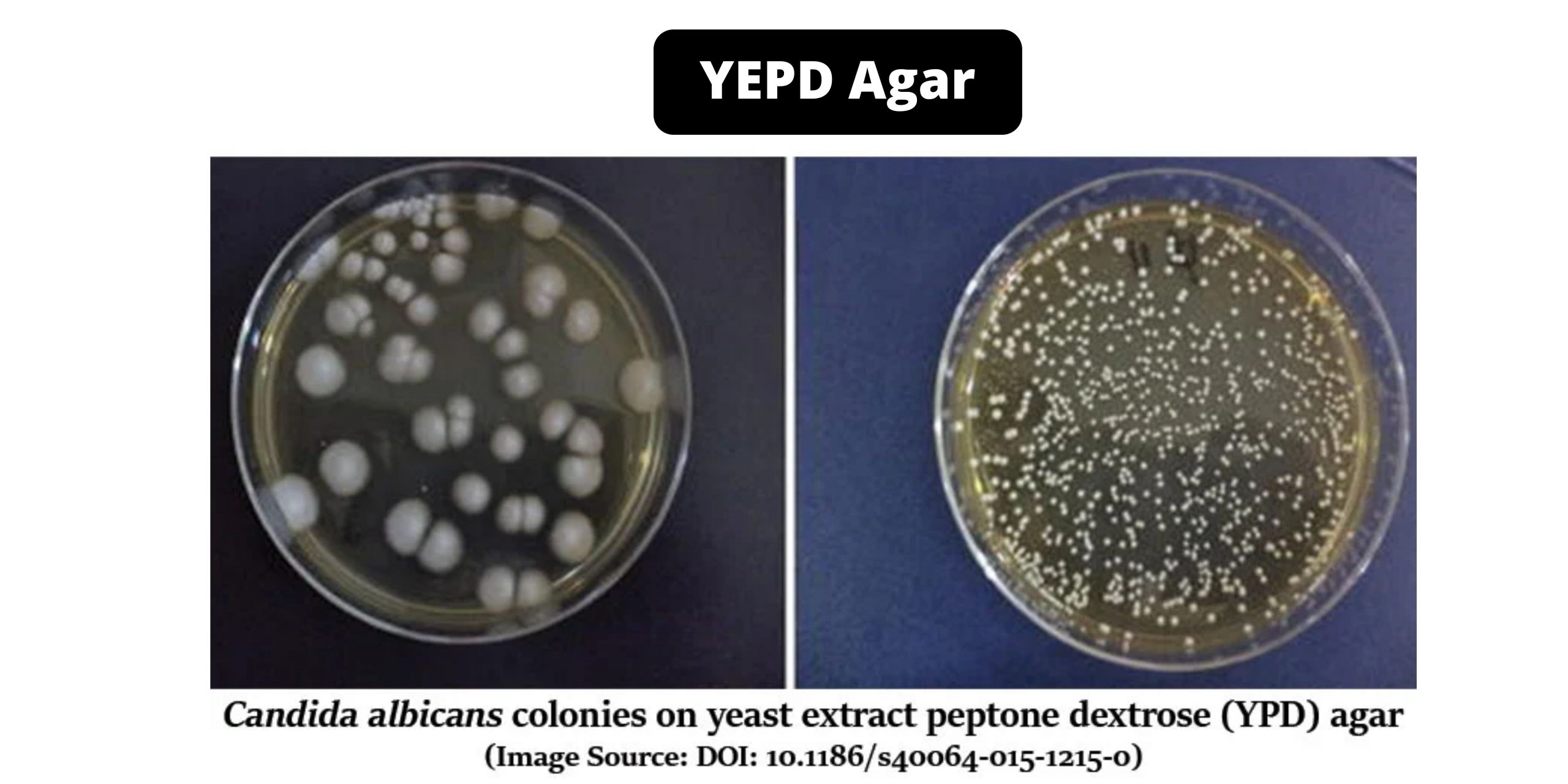 YEPD Agar - Composition, Principle, Preparation, Results, Uses