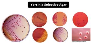 Yersinia Selective Agar – Composition, Principle, Preparation, Results, Uses