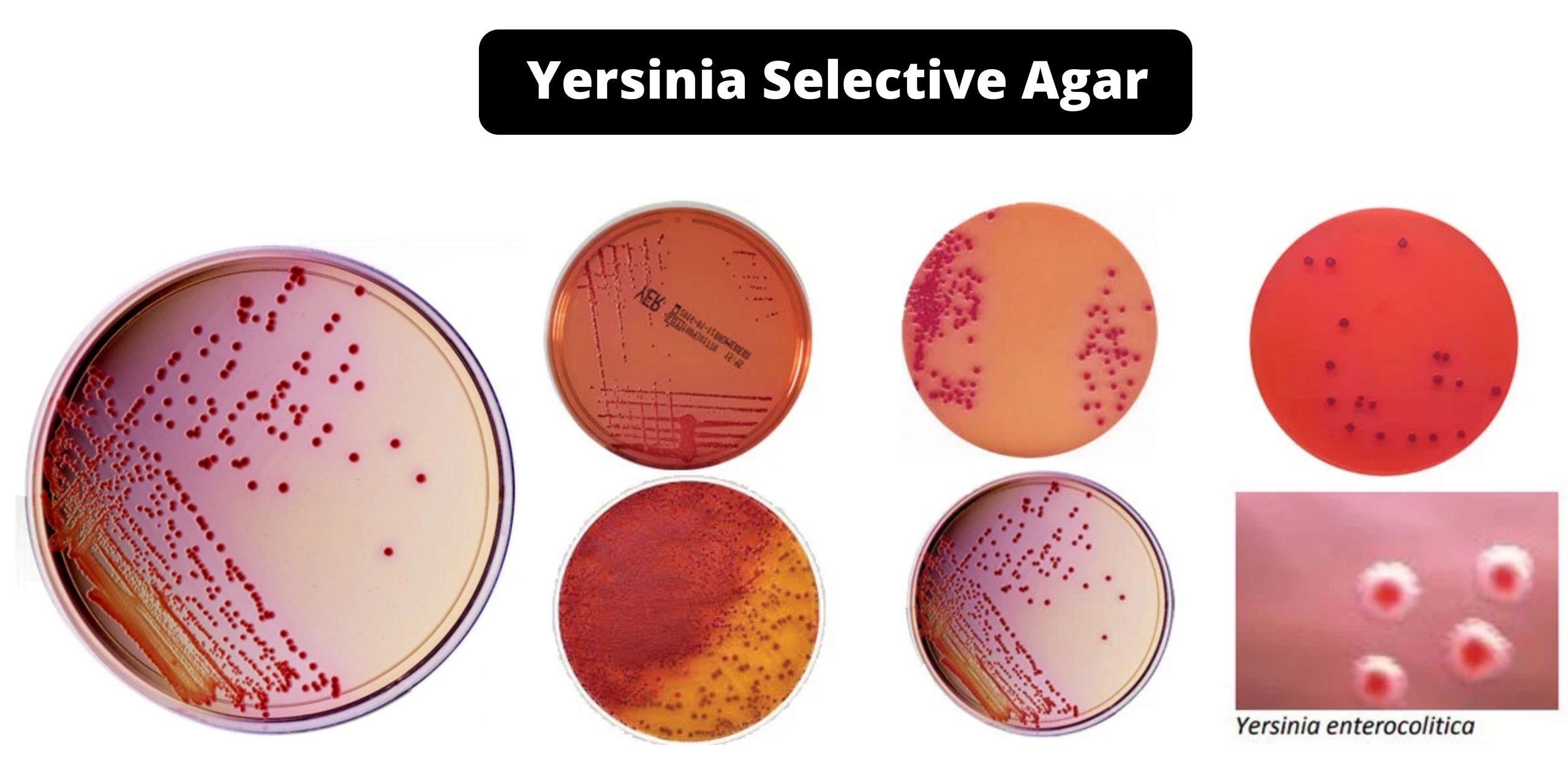 Yersinia Selective Agar - Composition, Principle, Preparation, Results, Uses