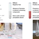 Millon’s Test Definition, Principle, Procedure, Result, Uses