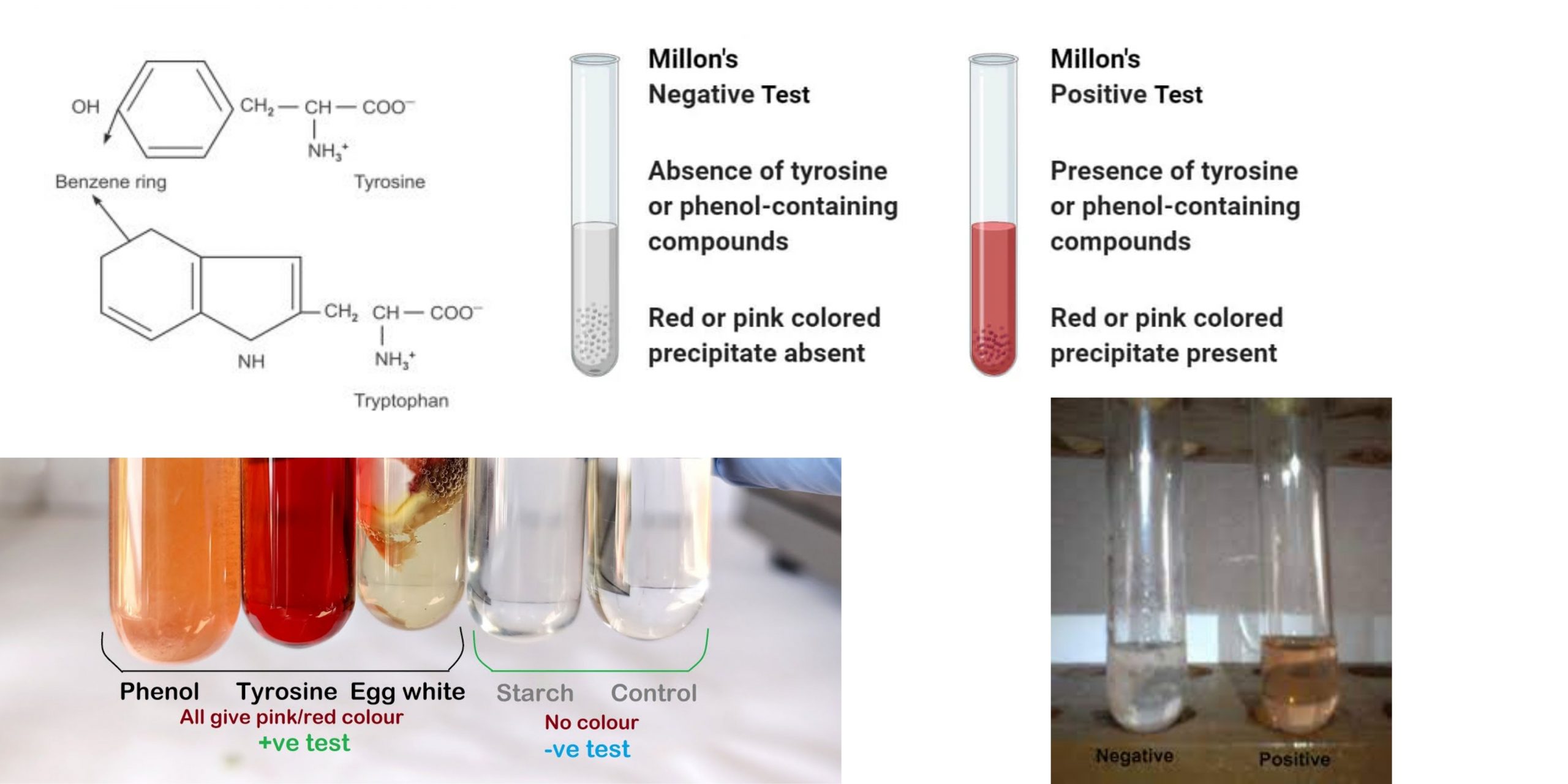 Millon’s Test Definition, Principle, Procedure, Result, Uses