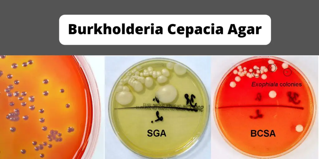 Burkholderia Cepacia Agar Base - Preparation, Composition, Principle ...