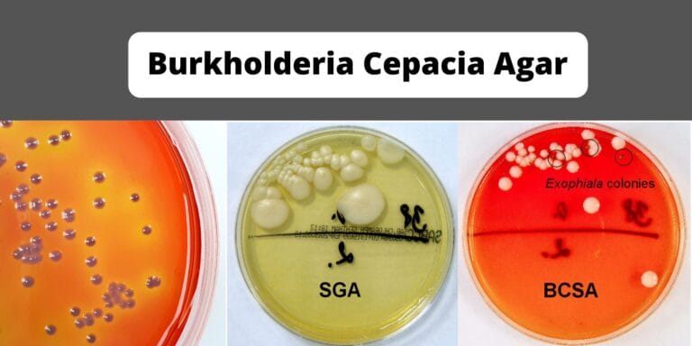Burkholderia Cepacia Agar Base Preparation, Composition, Principle