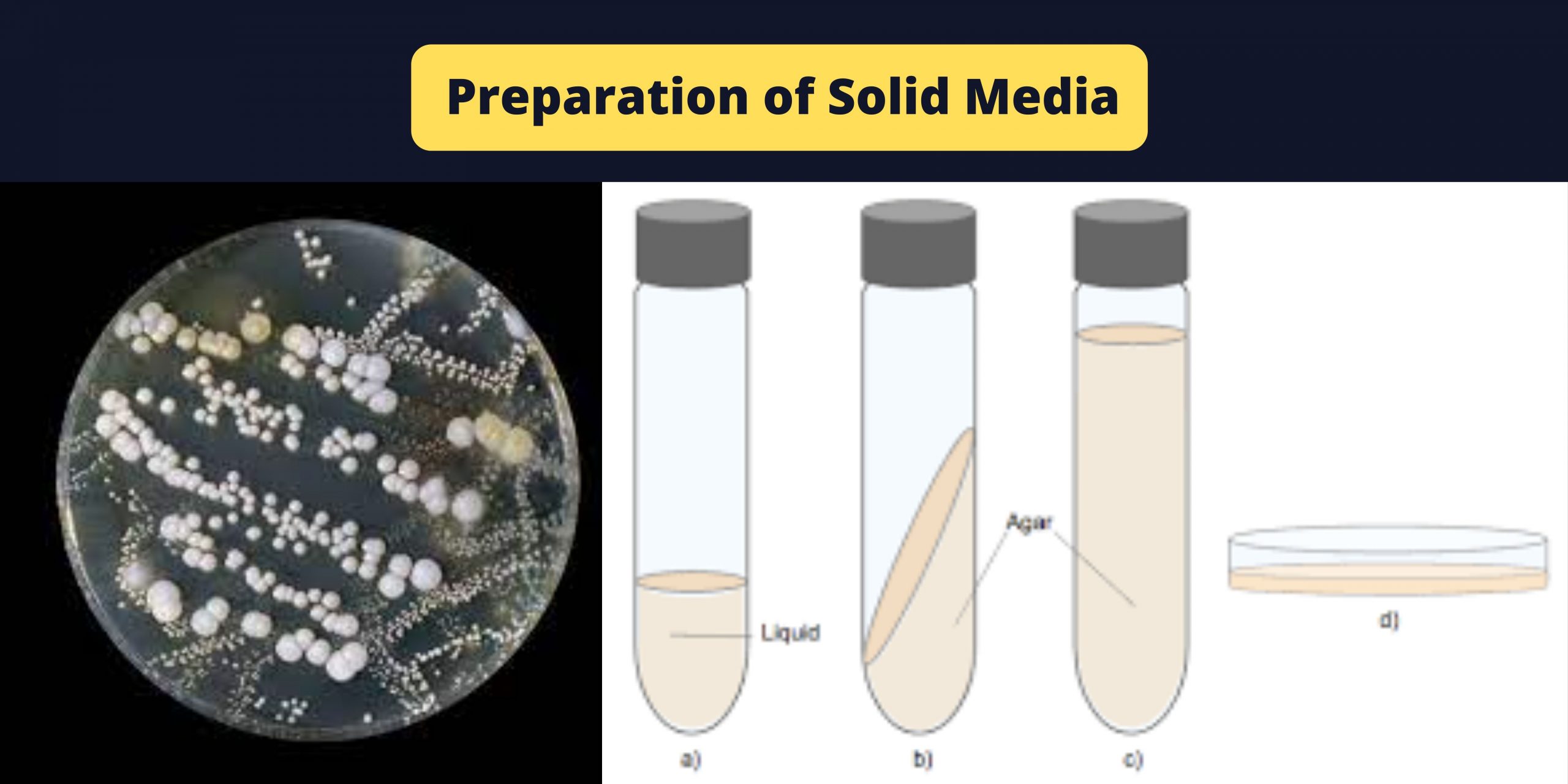 Preparation of Solid Media - Agar deep tubes, Agar Slants, Plates